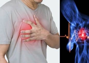 Cardiac arrest symptoms : కార్డియాక్ అరెస్ట్ అంటే ఏంటీ, దాని లక్షణాలు..