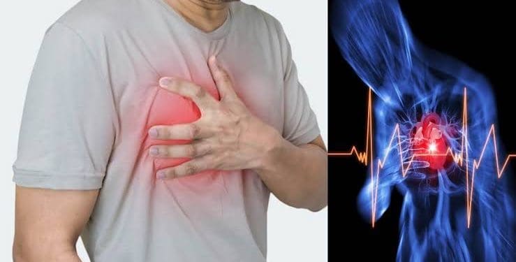 Cardiac arrest symptoms : కార్డియాక్ అరెస్ట్ అంటే ఏంటీ, దాని లక్షణాలు..