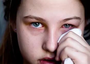 Eye Infections : తీవ్రంగా వ్యాపిస్తున్న కండ్ల కలక.. తీసుకోవాల్సిన జాగ్రత్తలు ఇవే..