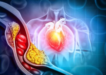 Symptoms of  High Cholesterol : ఈ లక్షణాలు మీలో కనిపిస్తున్నాయా..? జాగ్రత్త పడకపోతే ప్రాణానికే ప్రమాదం..
