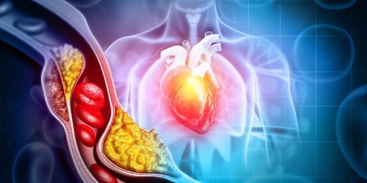 Symptoms of High Cholesterol : ఈ లక్షణాలు మీలో కనిపిస్తున్నాయా..? జాగ్రత్త పడకపోతే ప్రాణానికే ప్రమాదం..
