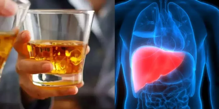 Liver – Alcohol : కాలేయం పాడవడానికి ఆల్కహాల్ ఒకటే కారణం కాదు.. ఈ అలవాట్లు ప్రమాదమే..