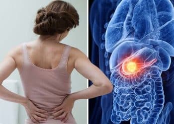 Kidney Failure Symptoms : కిడ్నీ ఫెయిల్యూర్ లక్షణాలు ఇవే..