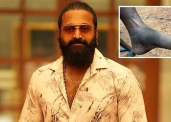 Rishab Shetty: ‘కాంతార చాప్టర్ 1’ క్లైమాక్స్ వెనుక కష్టం.. వాచిపోయిన కాళ్ల ఫొటోలతో రిషబ్ శెట్టి భావోద్వేగం