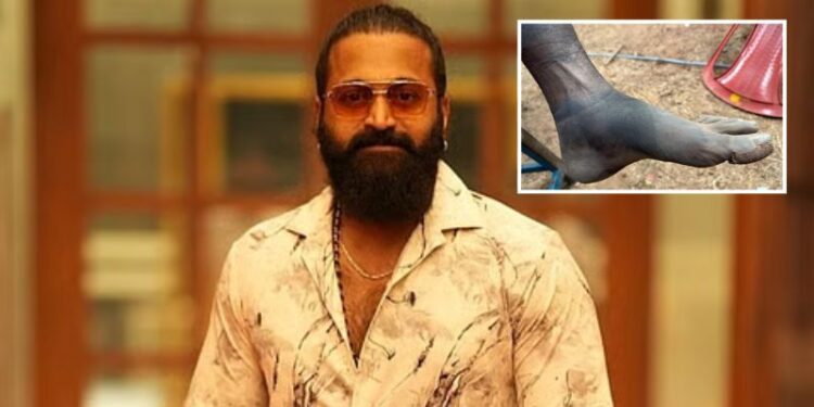 Rishab Shetty: ‘కాంతార చాప్టర్ 1’ క్లైమాక్స్ వెనుక కష్టం.. వాచిపోయిన కాళ్ల ఫొటోలతో రిషబ్ శెట్టి భావోద్వేగం